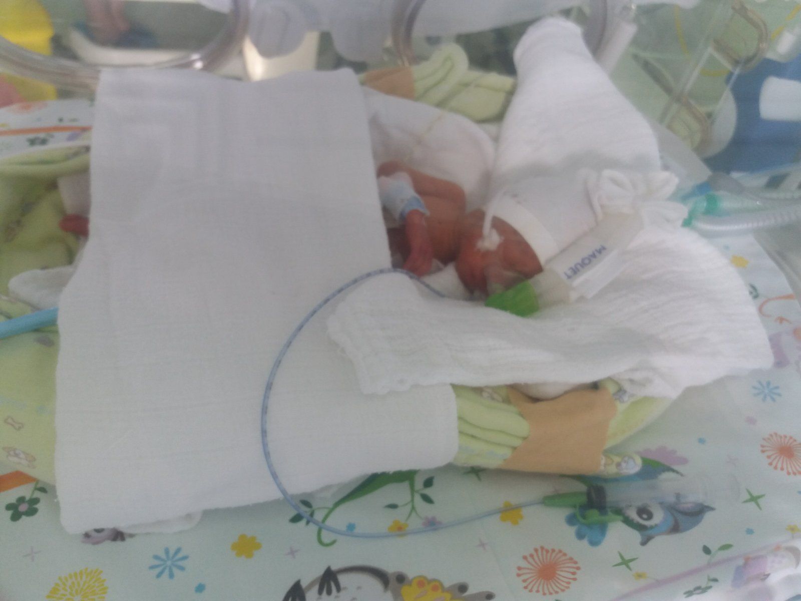 Hrabrost teška 660 grama: Priča o malom Vasiliju iz Banje Luke