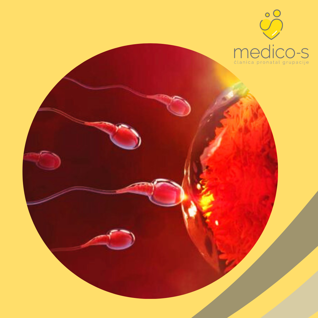 MSS (Mikrofluidno sortiranje spermatozoida)